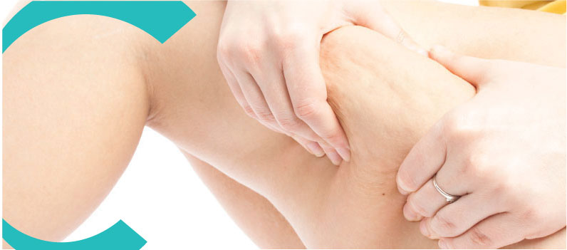 Qué es la Mesoterapia contra Celulitis