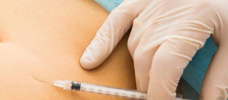 Mesoterapia Reductiva