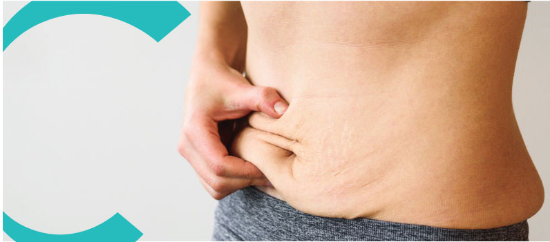 Tratamiento de Pérdida de Peso